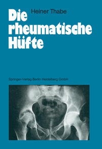 Die rheumatische Hüfte