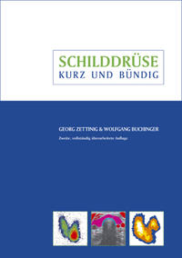 Schilddrüse - kurz und bündig