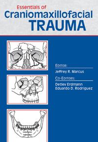 Essentials of Craniomaxillofacial Trauma