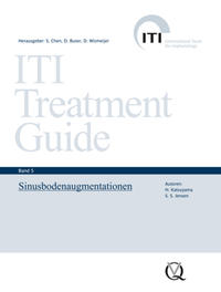 Sinusbodenaugmentation