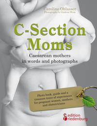 C-Section Moms - Caesarean mothers in words and photographs