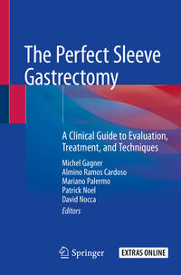 The Perfect Sleeve Gastrectomy