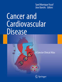 Cancer and Cardiovascular Disease