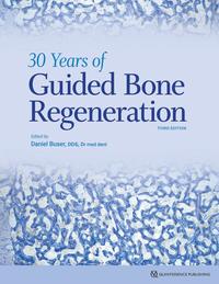 30 Years of Guided Bone Regeneration