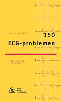 150 ECG-problemen