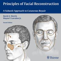 Principles of Facial Reconstruction