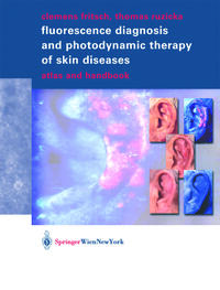 Fluorescence Diagnosis and Photodynamic Therapy of Skin Diseases