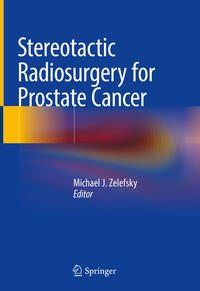 Stereotactic Radiosurgery for Prostate Cancer