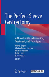 The Perfect Sleeve Gastrectomy