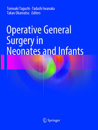 Operative General Surgery in Neonates and Infants