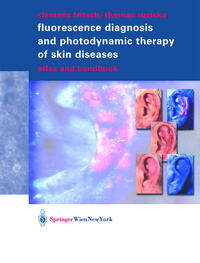 Fluorescence Diagnosis and Photodynamic Therapy of Skin Diseases