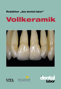 Vollkeramik