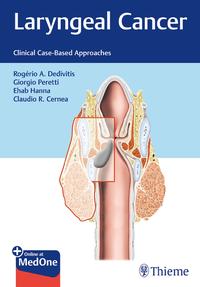 Laryngeal Cancer