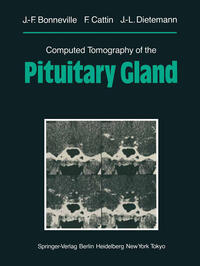 Computed Tomography of the Pituitary Gland