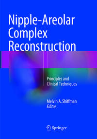 Nipple-Areolar Complex Reconstruction