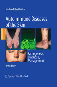 Autoimmune Diseases of the Skin