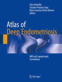 Atlas of Deep Endometriosis