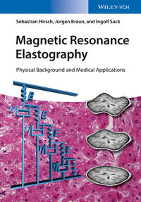 Magnetic Resonance Elastography