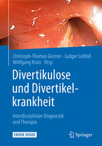 Divertikulose und Divertikelkrankheit