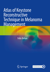 Atlas of Keystone Reconstructive Technique in Melanoma Management