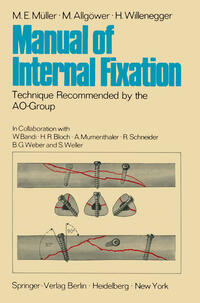 Manual of Internal Fixation