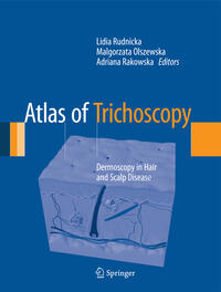 Atlas of Trichoscopy