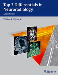 Top 3 Differentials in Neuroradiology