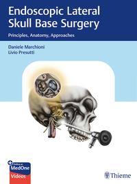 Endoscopic Lateral Skull Base Surgery