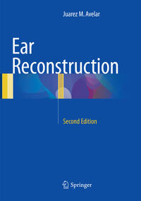 Ear Reconstruction