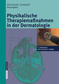 Physikalische Therapiemaßnahmen in der Dermatologie