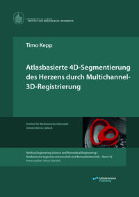 Atlasbasierte 4D-Segmentierung des Herzens durch Multichannel-3D-Registrierung