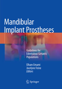 Mandibular Implant Prostheses