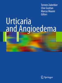 Urticaria and Angioedema