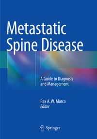 Metastatic Spine Disease