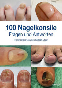 100 Nagelkonsile