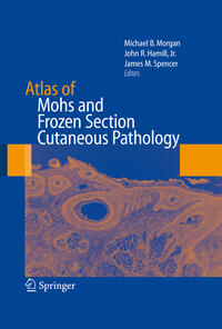 Atlas of Mohs and Frozen Section Cutaneous Pathology