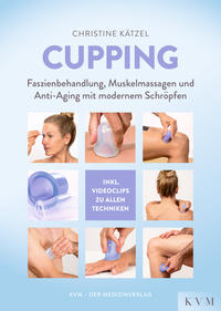 Cupping