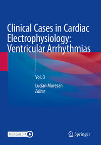 Clinical Cases in Cardiac Electrophysiology: Ventricular Arrhythmias