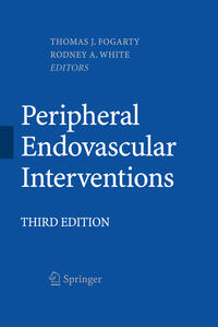 Peripheral Endovascular Interventions