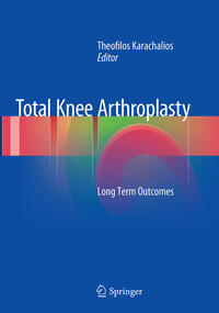 Total Knee Arthroplasty