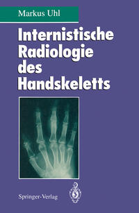 Internistische Radiologie des Handskeletts