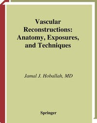 Vascular Reconstructions