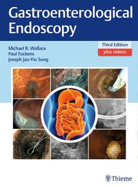 Gastroenterological Endoscopy