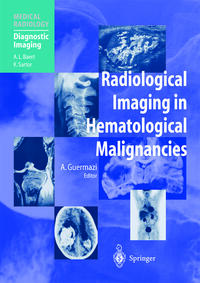 Radiological Imaging in Hematological Malignancies