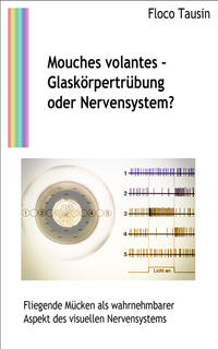 Mouches volantes - Glaskörpertrübung oder Nervensystem?