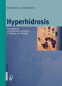 Hyperhidrosis