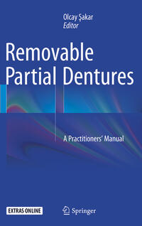 Removable Partial Dentures