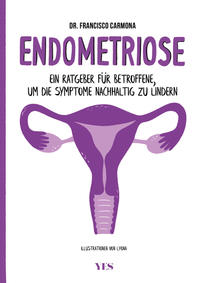 Endometriose