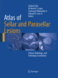 Atlas of Sellar and Parasellar Lesions