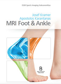 MRI Foot & Ankle